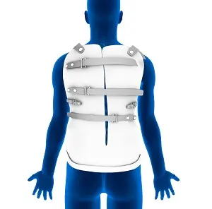 Non-Surgical Scoliosis Treatment in Mumbai-dr nikhil arbatti